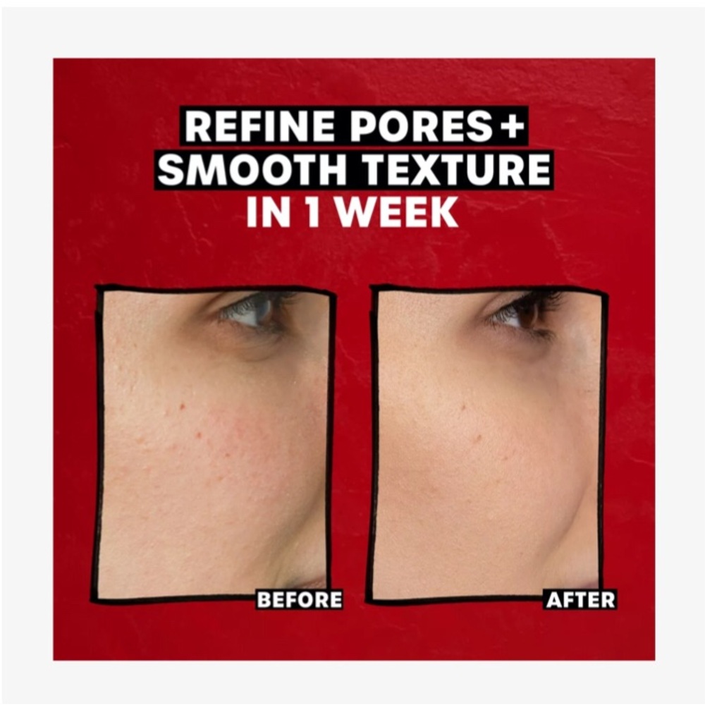 Thayers 2% AHA Exfoliating Toner with Red Cap - Picture 3 of 4